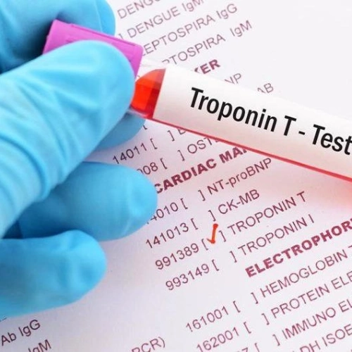 Định lượng Troponin T hs